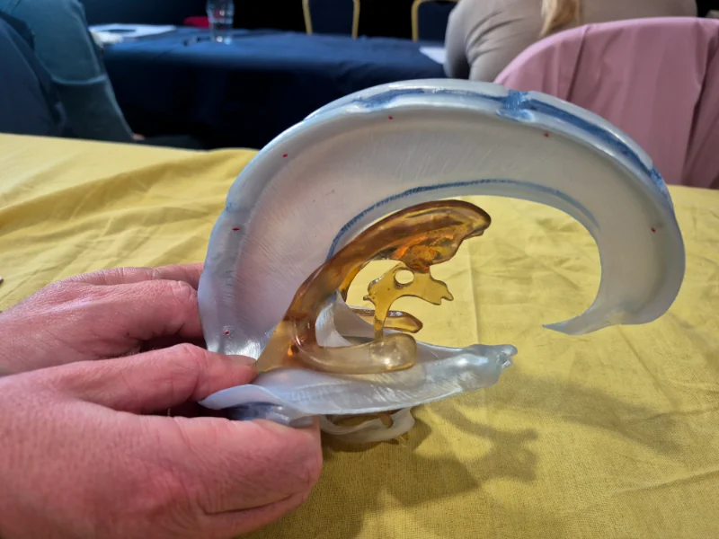 The ventricles and membrances